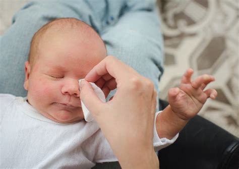 yeni doğan bebekte gözde çapaklanma